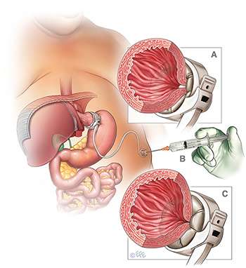 Atlas Of Bariatric and Metabolic Surgery Image