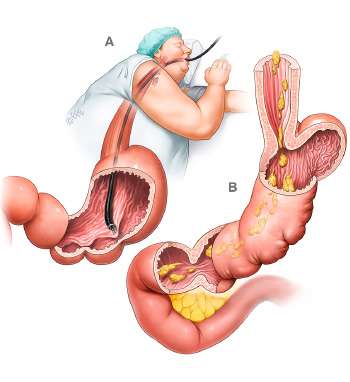 Atlas Of Bariatric and Metabolic Surgery Image