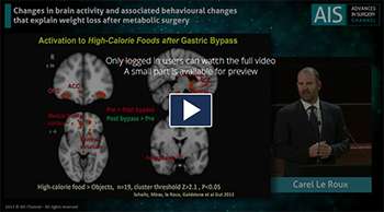 IFSO 2017 KEY NOTE LECTURES CAREL LE ROUX ON BRAIN ACTIVITY