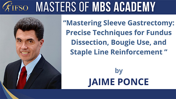 Mastering Sleeve Gastrectomy: Precise Techniques for Fundus Dissection, Bougie Use, and Staple Line Reinforcement