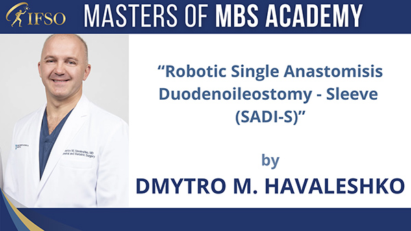 Robotic Single Anastomisis Duodenoileostomy - Sleeve (SADI-S) - Dmytro M. Havaleshko