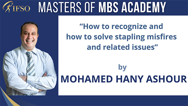 How to Recognize and how to solve stapling misfires and related issues - Mohamed Hany