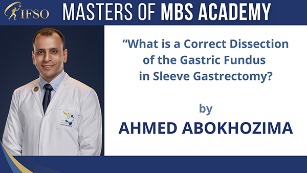 What is a Correct Dissection of the Gastric Fundus in Sleeve Gastrectomy?