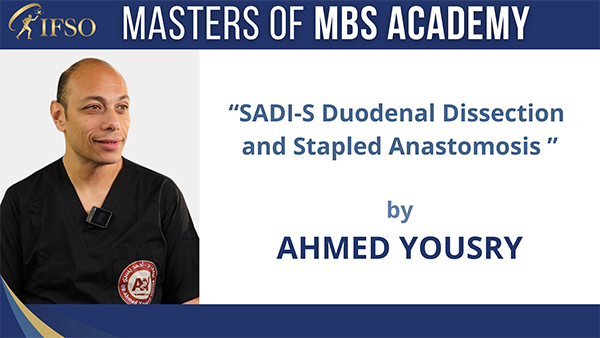 SADI-S Duodenal Dissection and Stapled Anastomosis - Ahmed Yousry